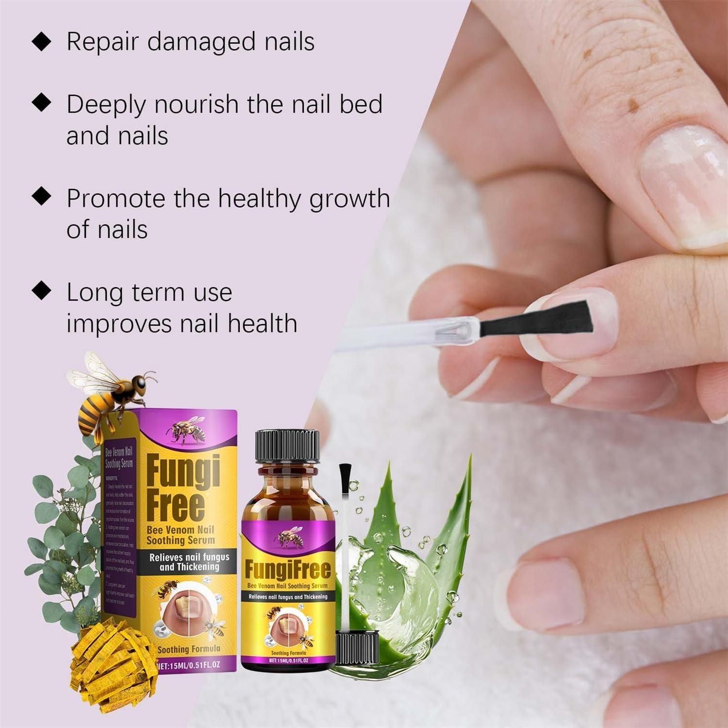 Fungi Free Bee Venom Nail Treatment Solution Serum (15ml) (Pack of 2) - Moby Mart